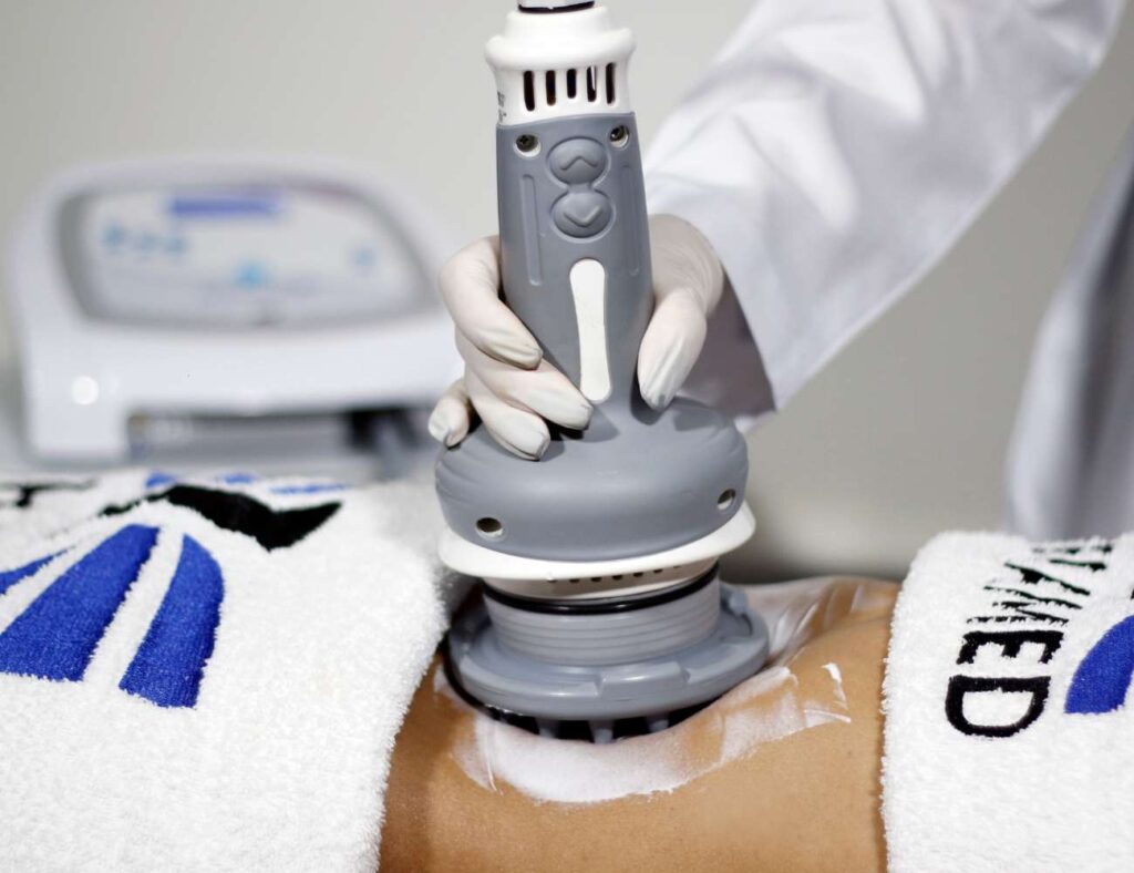 Aplicação do equipamento Modellata com a ponteira "Multipontas", para o tratamento de gordura localizada, promovendo a modelagem corporal. - Modellata