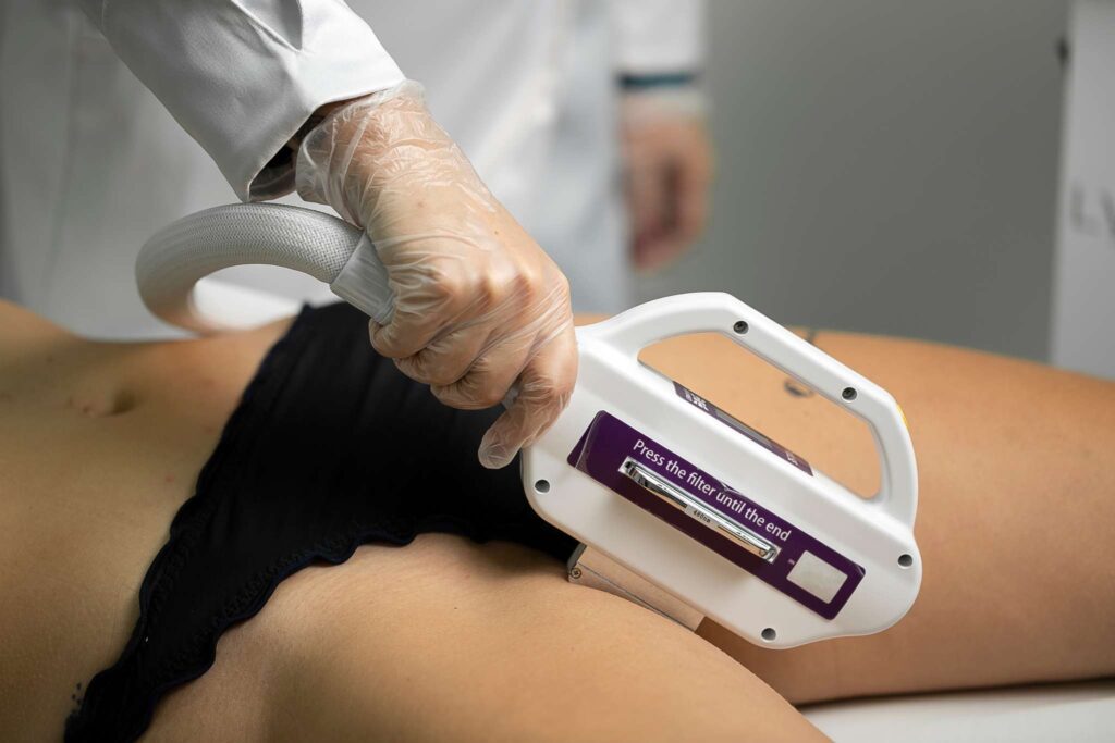 Estética íntima com Lyra da Ibramed, epilação com Luz Intensa Pulsada
