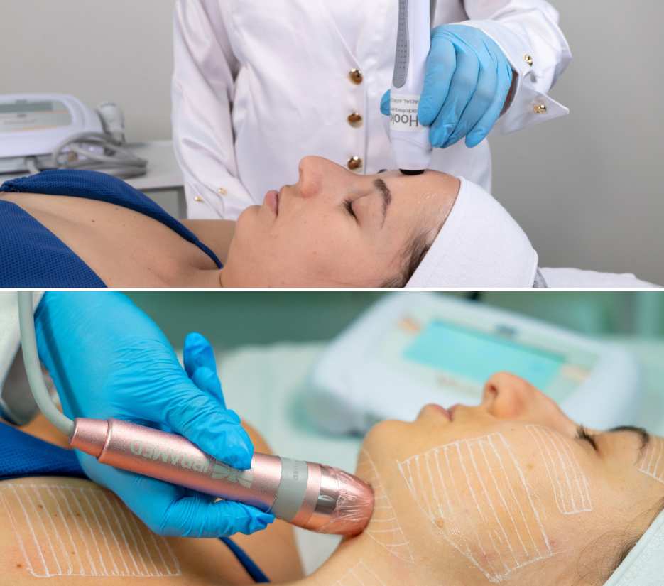 Radiofrequência associado ao Ultrassom Microfocado em tratamentos faciais