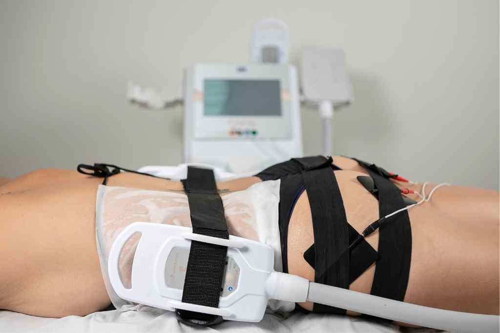 Criolipólise associada a eletroestimulação