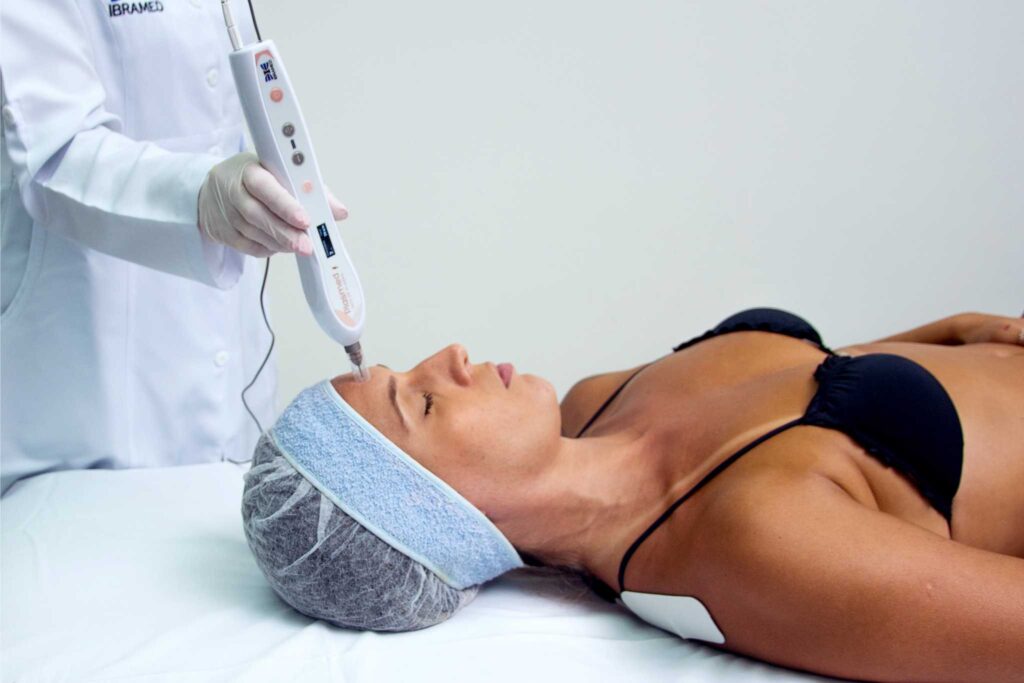 Rejuvenescimento facial com redução de linhas de expressão com Jato de Plasma - Plasmed IBRAMED