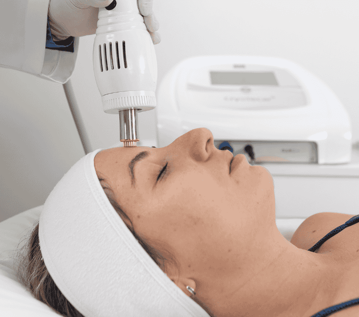 Procedimento Estético Não invasivo - Radiofrequência Fracionada ablativa e não invasiva Cryotecar