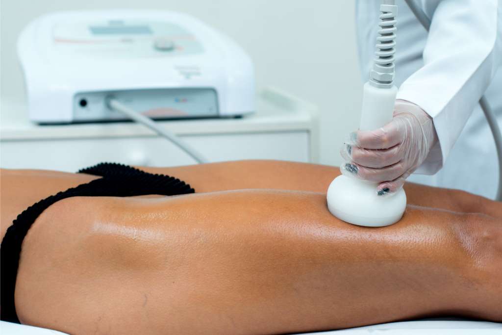 Radiofrequência associada a Vacuoterapia para tratamento de celulite - Dermotonus Esthetic