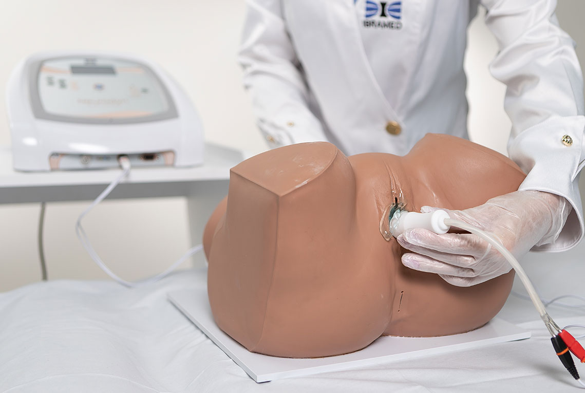 eletroestimulacao-assoalho-pelvico-intravaginal-ibramed.jpg