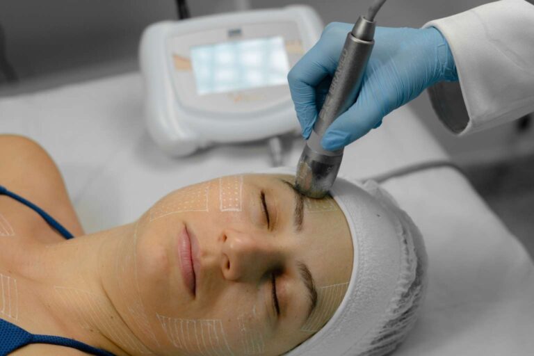 Ultrassom Microfocado Visage para Harmonização Facial