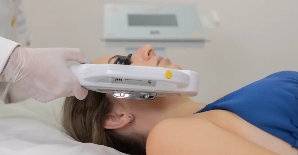 Luz Intensa Pulsada Lyra Ibramed