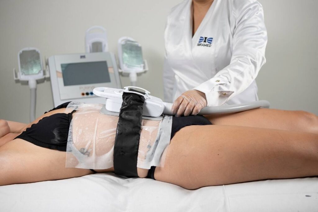 criolipolise_de_placas_estatica_harmonizacao_corporal